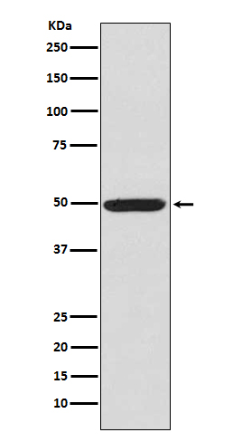 Phospho-PKA R2 (S99) Rabbit mAb