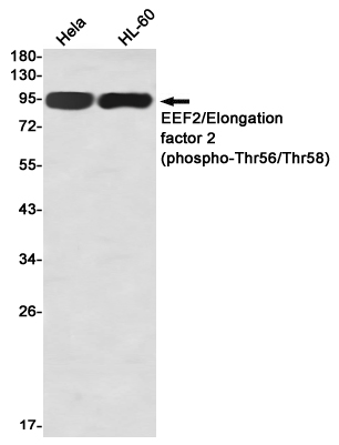 Phospho-EEF2 (Thr56/Thr58) Rabbit mAb
