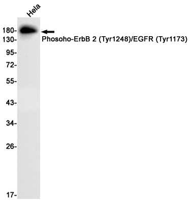 Phospho-ErbB 2 (Tyr1248)/ErbB 4 (Tyr1284) Rabbit mAb