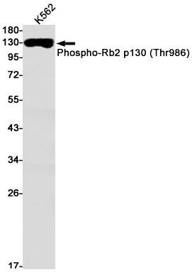 Phospho-p130 (Thr986) Rabbit mAb