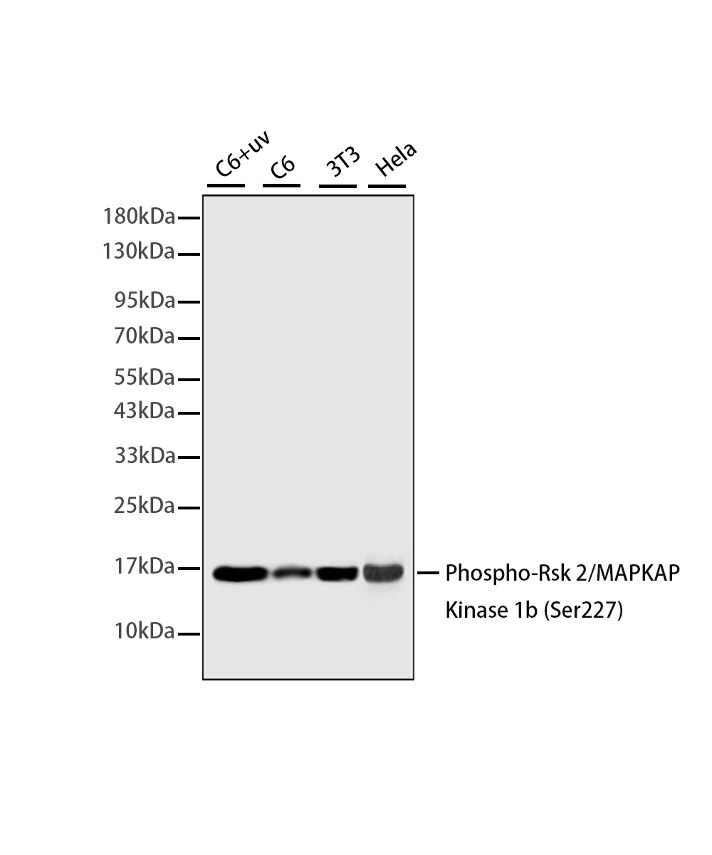 Phospho-RSK2 (Ser227) Rabbit mAb