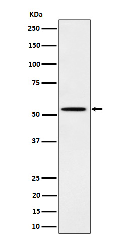 Phospho-Src (Y529) Rabbit mAb