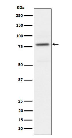 Phospho-PKC alpha (T497) Rabbit mAb