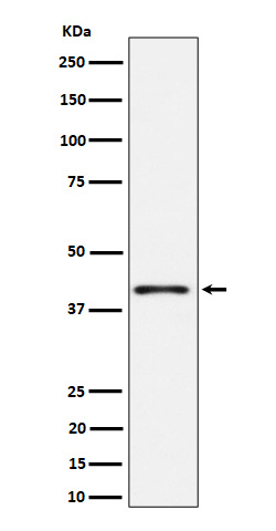 Phospho-p38 (T180) Rabbit mAb