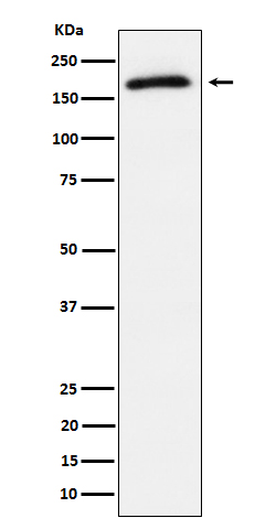 Phospho-AS160 (T642) Rabbit mAb