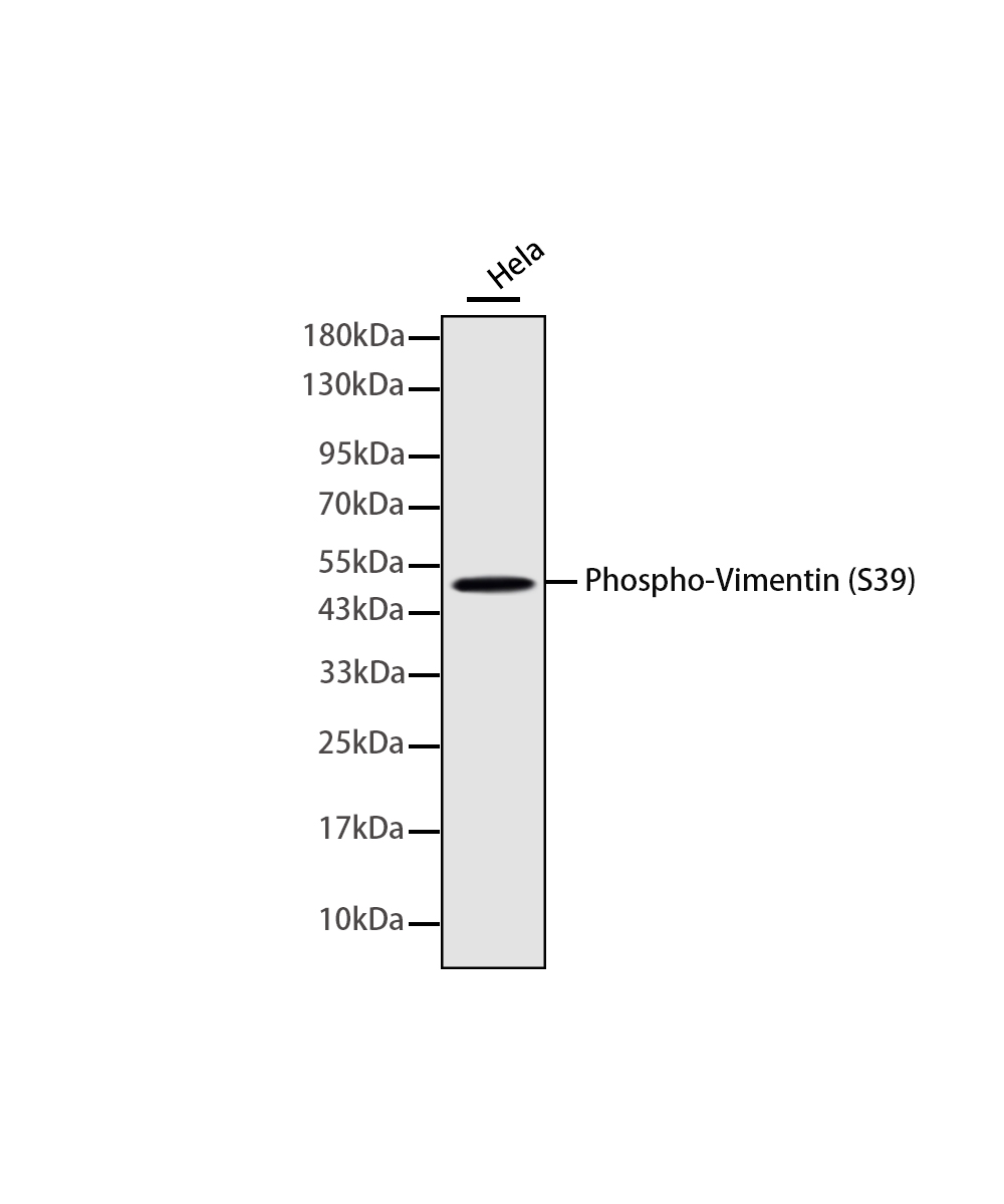 Phospho-Vimentin (S39) Rabbit mAb