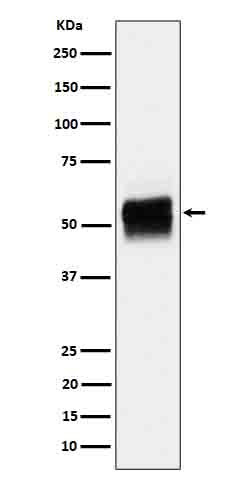 Phospho-Tau (S202) Rabbit mAb