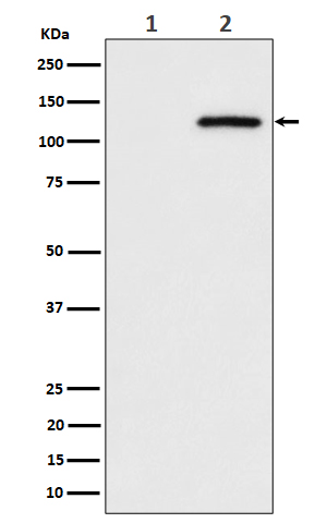 Phospho-CBL (S669) Rabbit mAb