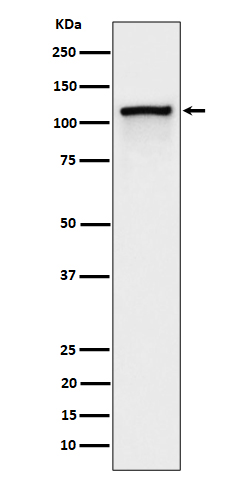 Phospho-CBL (Y774) Rabbit mAb
