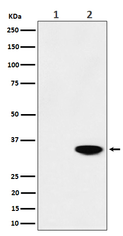 Phospho-Nucleophosmin (T199) Rabbit mAb