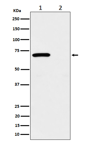 Phospho-Chk2 (T68) Rabbit mAb