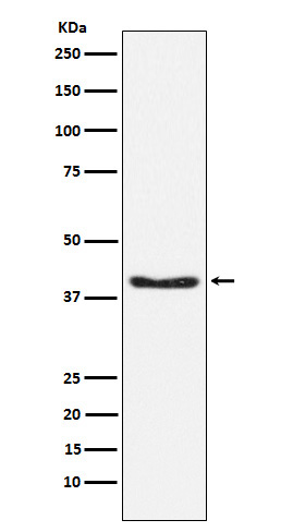 Phospho-PDHA1 (S293) Rabbit mAb