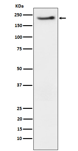 Phospho-ErbB3 (Y1222) Rabbit mAb