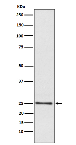 Lysophospholipase 1 (18C9) Rabbit mAb