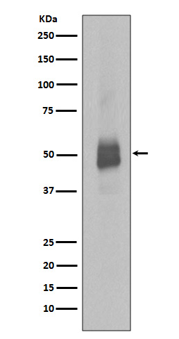 Phospho-Lyn (Y396) Rabbit mAb