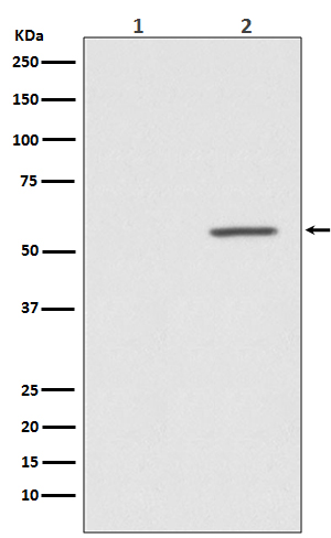 Phospho-AKT1 (S124) Rabbit mAb