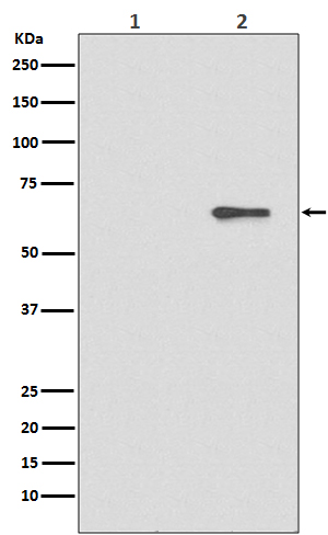 Phospho-AMPK alpha 2 (S491) Rabbit mAb