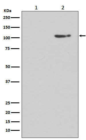Phospho-GluR1 (S845) Rabbit mAb