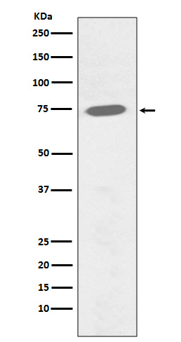 Phospho-BTK (Y551) Rabbit mAb