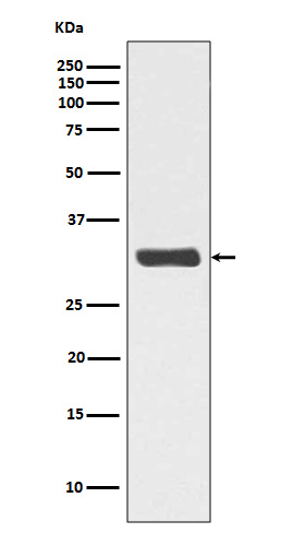 Phospho-RPA2 (T21) Rabbit mAb