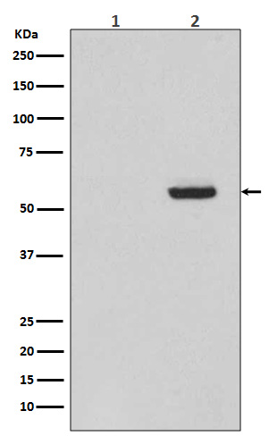 Phospho-Tau (S396) Rabbit mAb