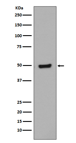 Phospho-GATA3 (S308) Rabbit mAb