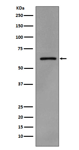 Phospho-Src (Y419) Rabbit mAb