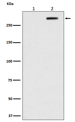 Phospho-ATM (S1981) Rabbit mAb