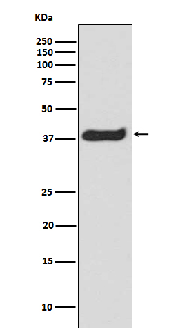 Phospho-LAT (Y220) Rabbit mAb
