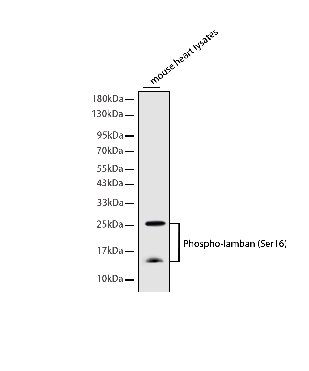 Phospho-Phospholamban (Ser16) Rabbit mAb