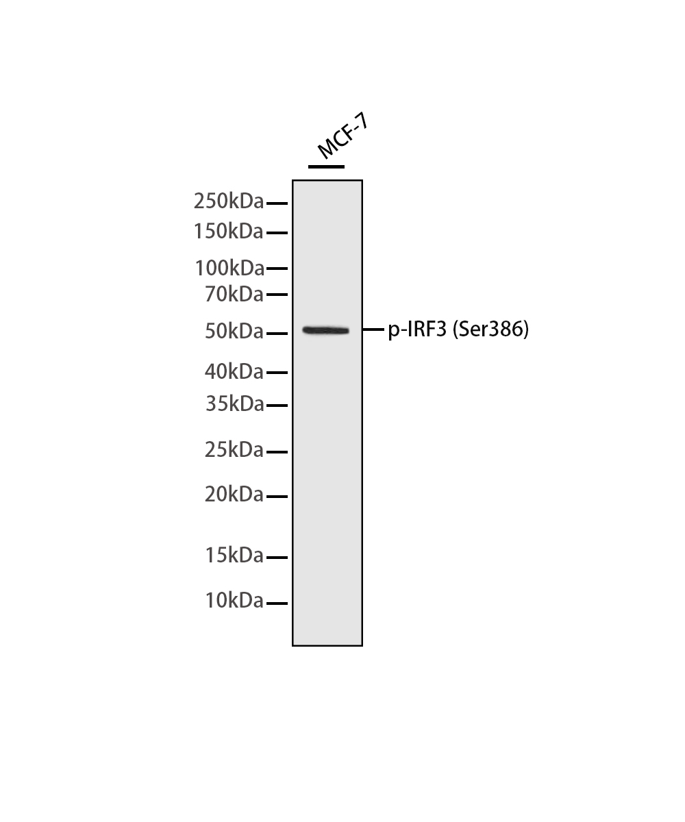 Phospho-IRF3 (Ser386) Rabbit mAb