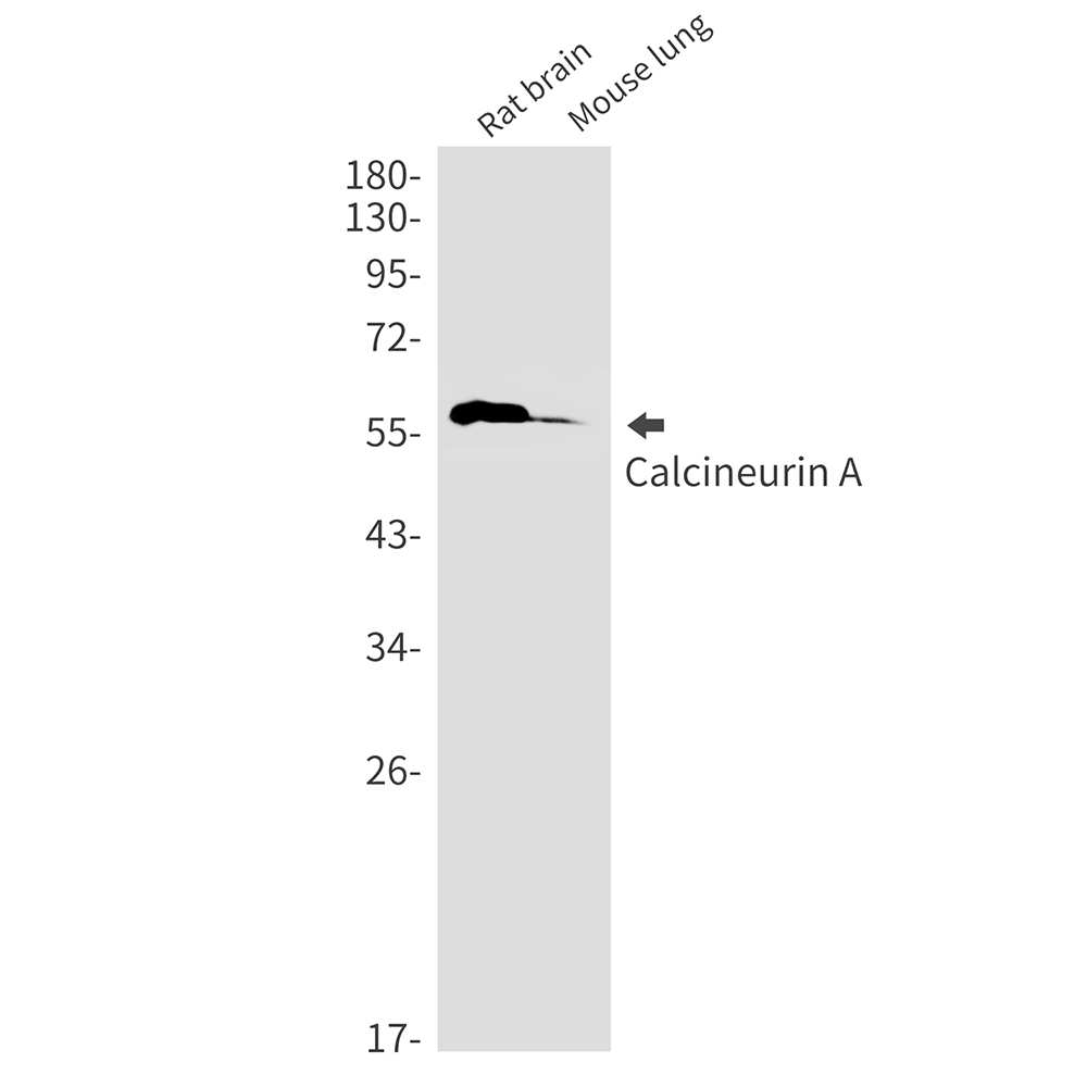 Calcineurin A Rabbit mAb