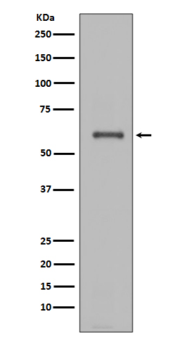 NOX4  Rabbit mAb