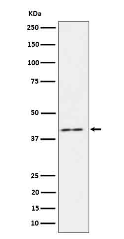 IL18 binding protein Rabbit mAb