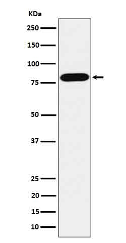 ABCD1 / ALD  Rabbit mAb
