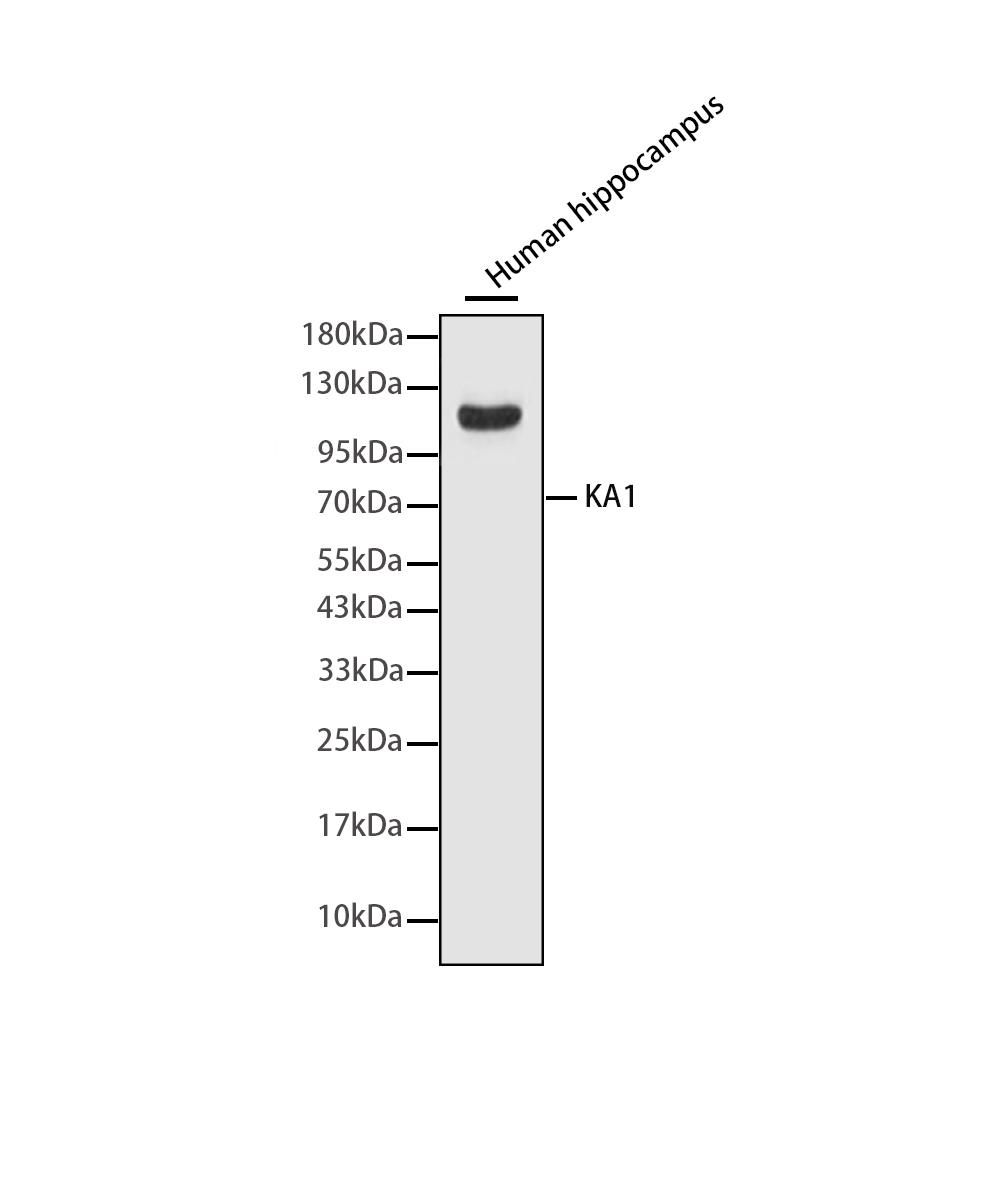 KA1 Rabbit mAb