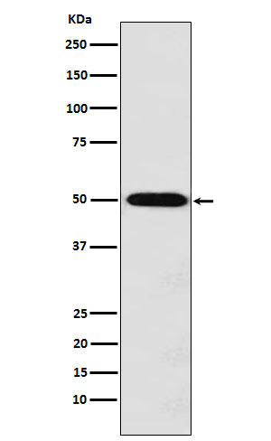 MCT1 Rabbit mAb