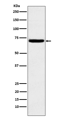 Heparanase 1 Rabbit mAb
