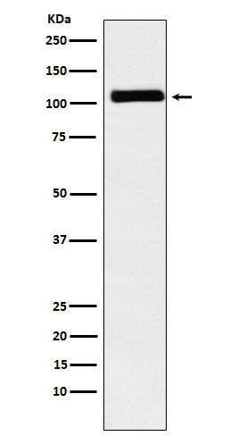 MIB1 / DIP1 Rabbit mAb