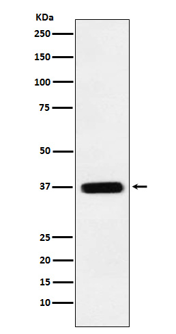 TMEM173 Rabbit mAb