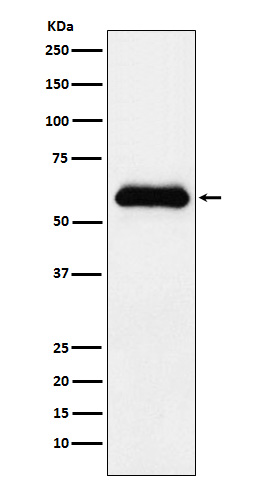alpha 1 Antichymotrypsin  Rabbit mAb