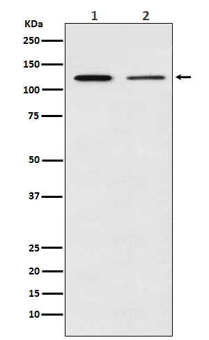 NF-κB p100/p52  Rabbit mAb