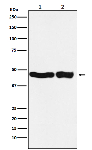 UQCRC2  Rabbit mAb