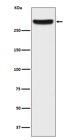 IP3 Receptor Rabbit mAb