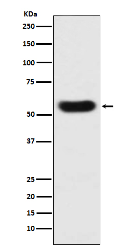 SERPINC1  Rabbit mAb