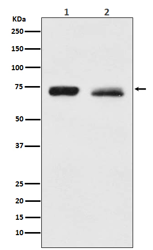 NF2 / Merlin Rabbit mAb