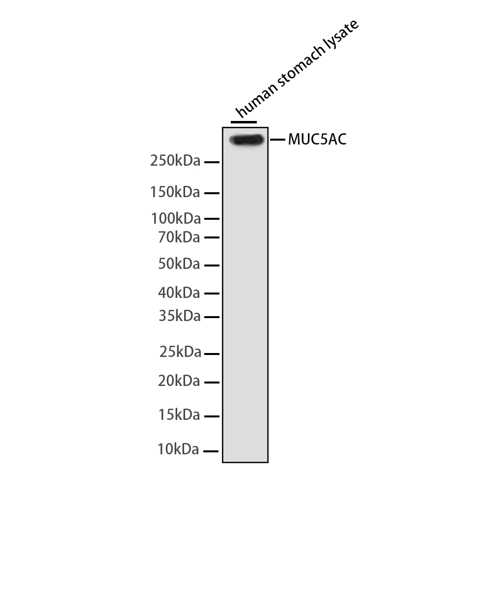 MUC5AC Rabbit mAb
