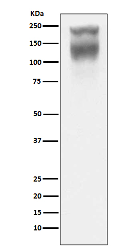 CEARabbit mAb