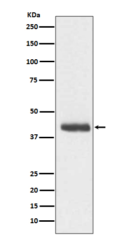 DCX Rabbit mAb