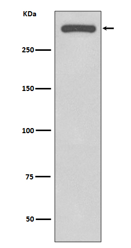DNA-PKcs Rabbit mAb